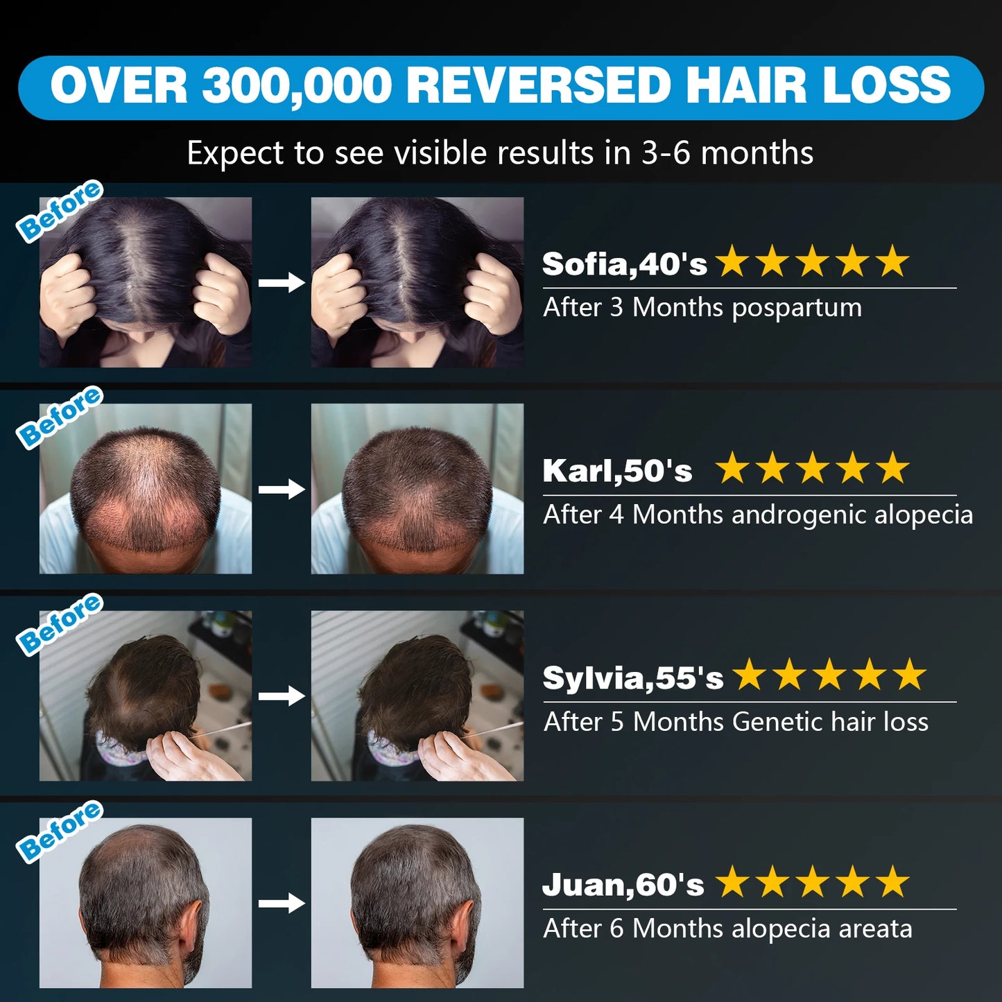 120 Diodes Hair Growth Laser Cap 850nm 660nm Anti Hair Loss Stress Relief Infrared Light Relaxation Therapy 4 Levels Pluse Mode