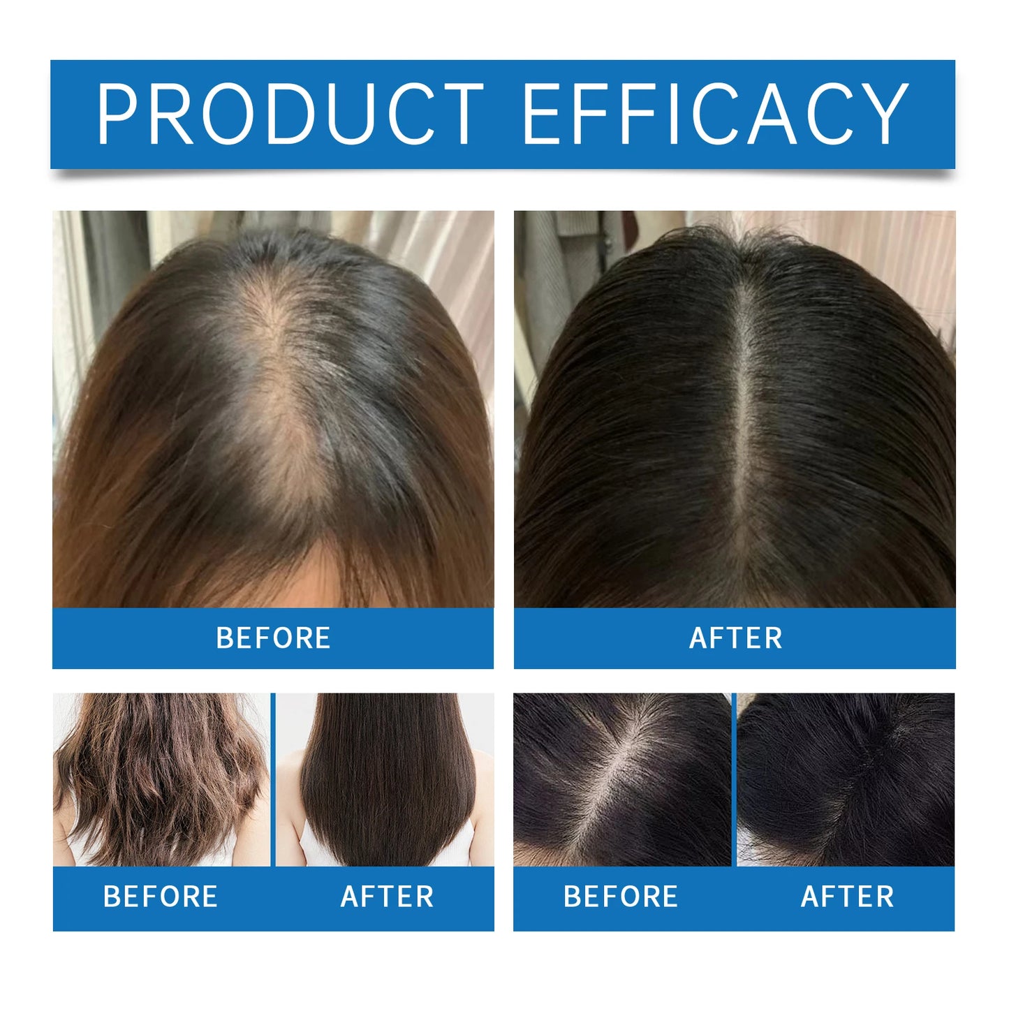 Fast Hair Growth Serum Nourish Hair Follicle Massage Scalp Care Essential Oil Roller Improve Dry Frizzy Hair Smoothing Essence