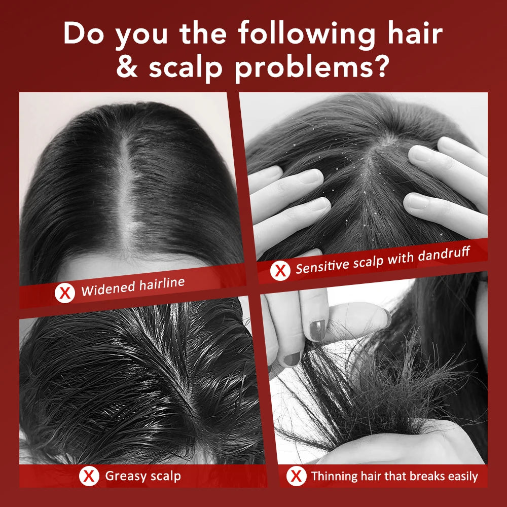 Electric Laser Hair Growth Comb Wireless Infrared Ray Massage Comb Hair Brush Anti Hair-loss Red and Blue light Head Massager