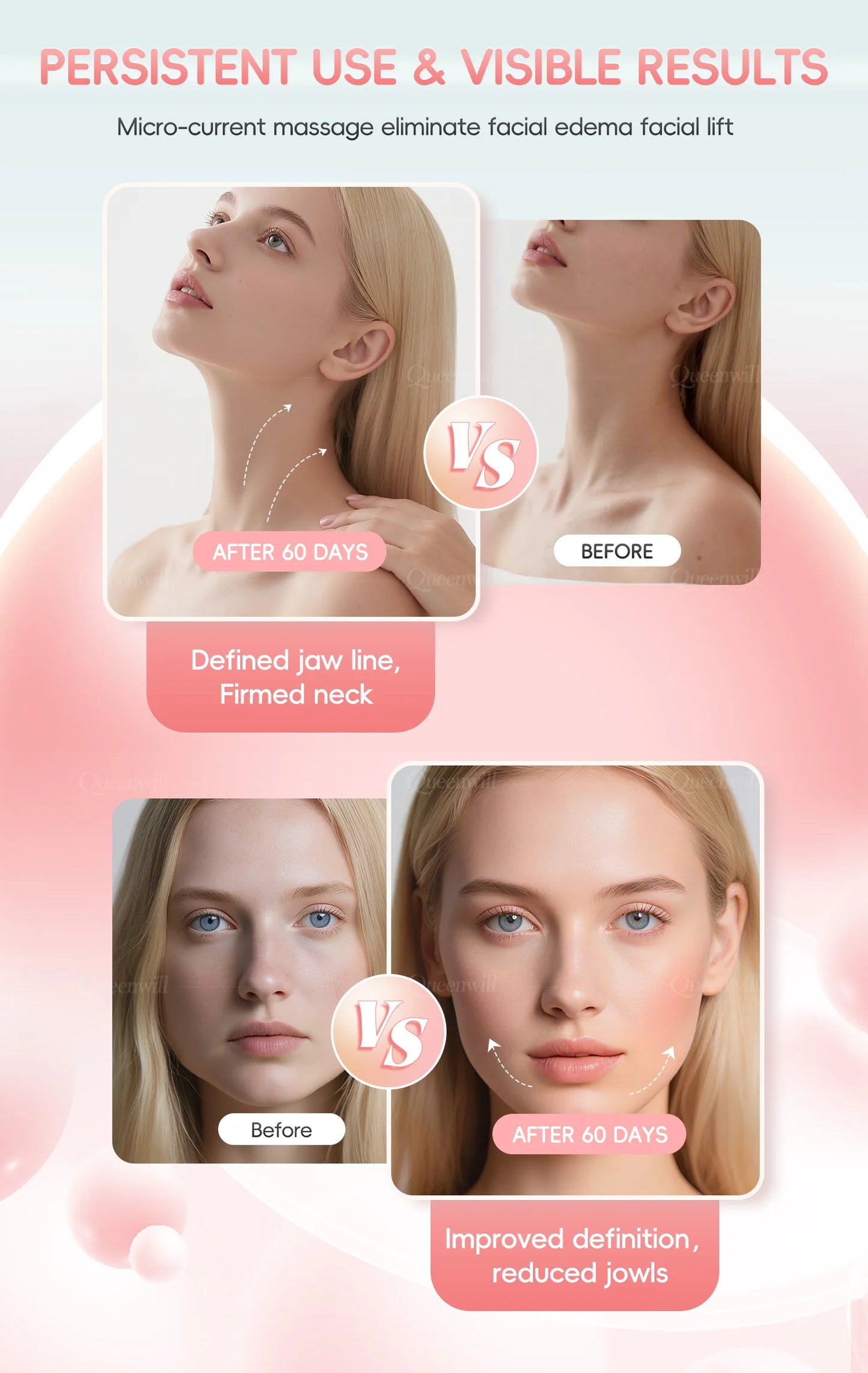 Face Lifting Devices Microcurrent Facial Massager EMS Slimming Face Tool Sonic Vibration Roller Charging Beauty Tightening