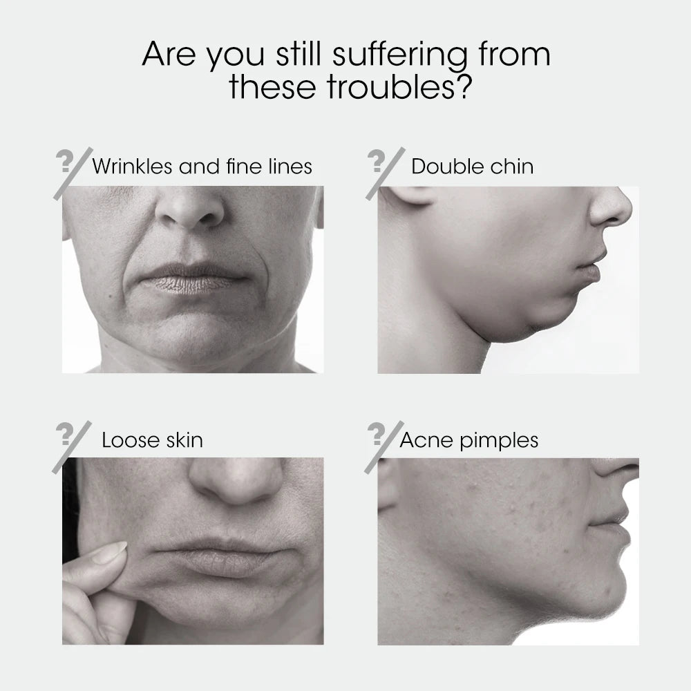 EMS microcurrent Face Lifting Device Red Light Skin Rejuvenation V Face Massager Double Chin Lift Up Facial Beauty Instrument