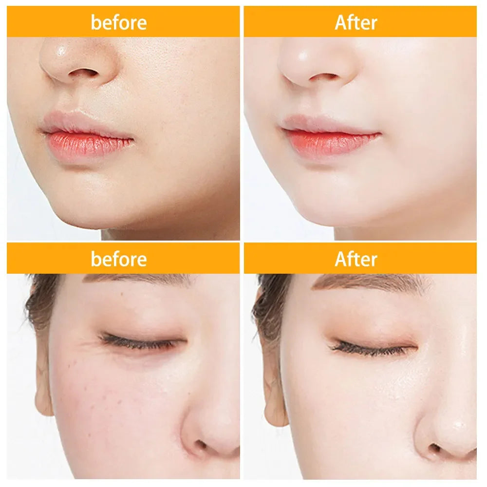 30Pcs Hyaluronic Acid Capsules Serum Hydrating Repair Moisturizing Essence Liquid Facial Deeply Nourishes Firming Skin Care