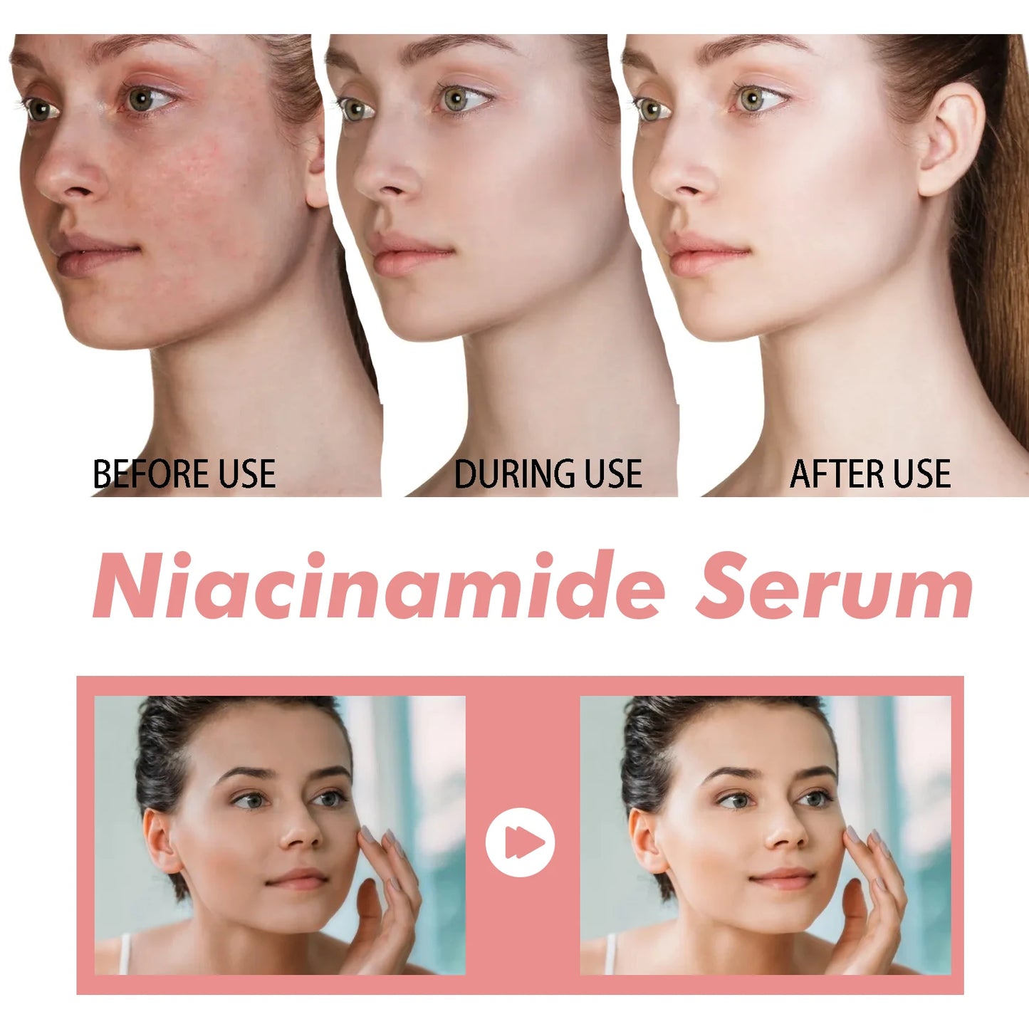 Niacinamide Facial Serum Fade Melanin Moisturzing Rejuvenation Shrink Pores Smooth Brightening Skin Care Dark Spot Remover Serum