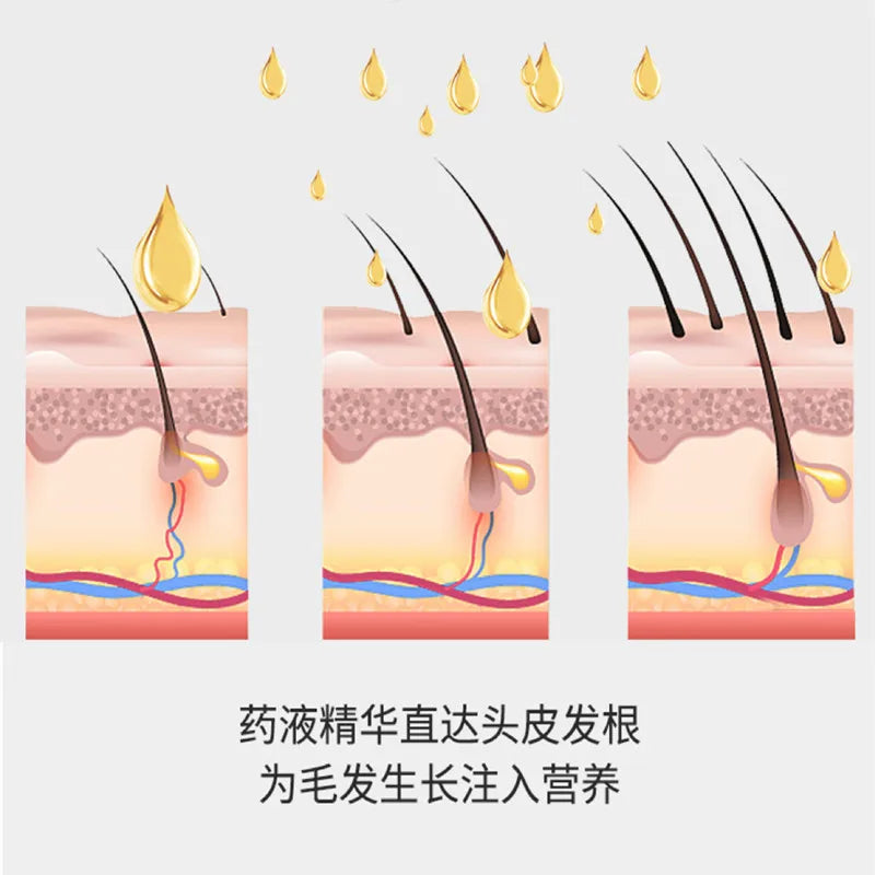 Scalp Liquid Serum Oil Applicator Comb for Hair Scalp Treatment Essential Oil Liquid Guiding Massager Comb Hair Growth Garrafa