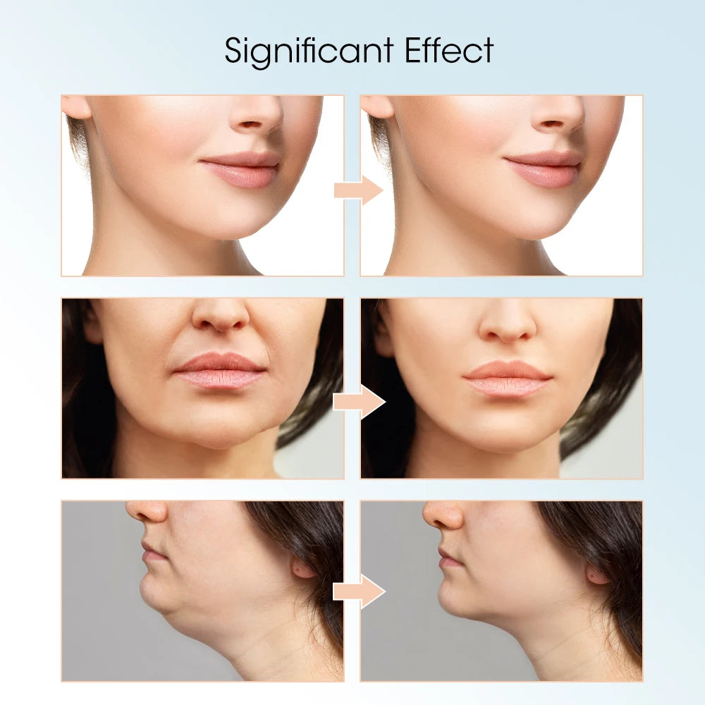 EMS microcurrent Face Lifting Device Red Light Skin Rejuvenation V Face Massager Double Chin Lift Up Facial Beauty Instrument